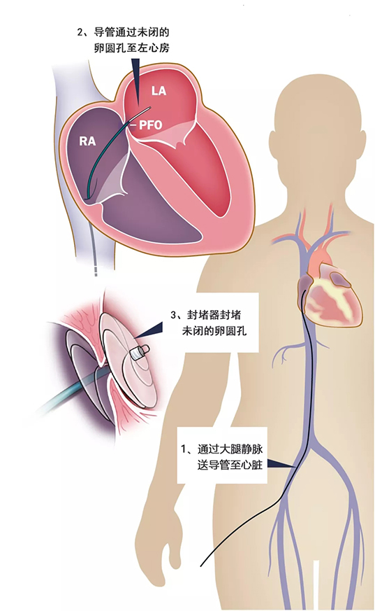 640.webp (9).jpg